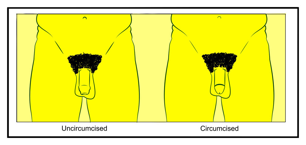Front view cartoon images of an uncircumsised penis and a circumcised penis Front view cartoon images of an uncircumsised penis and a circumcised penis